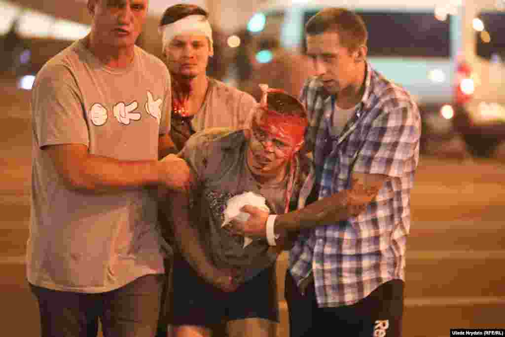 Unui bărbat rănit i se acordă primul ajutor, în Minsk. Poliția a tras cu gloanțe de cauciuc, grenade și gaze lacrimogene către protestatarii care îl acuză pe președintele Aleksandr Lukașenka că a falsificat rezultatele alegerilor din 9 august.