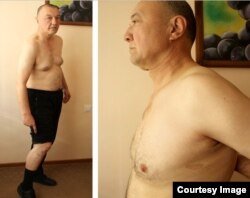 Ибрагим Дехканбаев показывает шрамы от пыток.