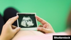 Иллюстрациялык сүрөт. 